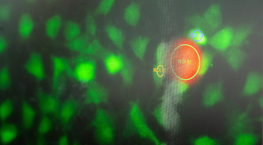 Ein Nanoroboter (orange) im Labor der Starting-Grant-Gewinnerin Prof. Berna Özkale Edelmann von der TUM. Mit solchen winzigen Robotern und sogenannten smarten Mikrogelen will sie die Entwicklung von Stammzellen beeinflussen (© Astrid Eckert/TUM)